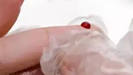 呼和浩特血缘检测样本有哪几种, 呼和浩特血缘检测样本有哪几种,